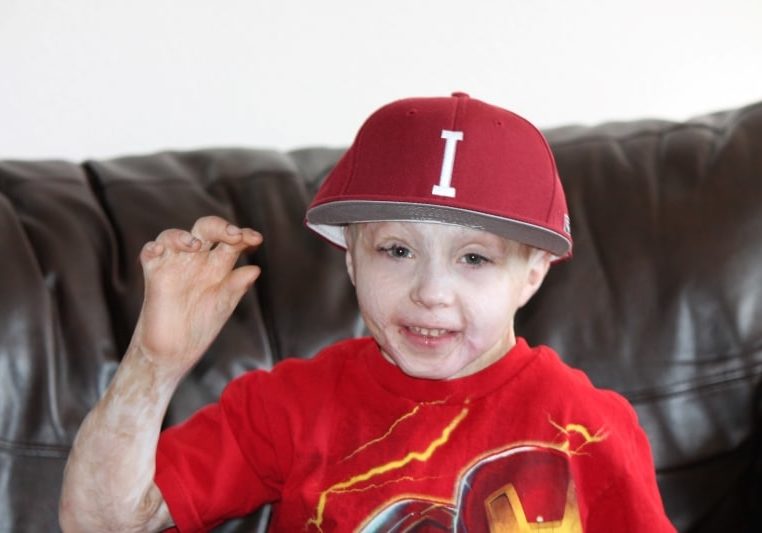 Owen